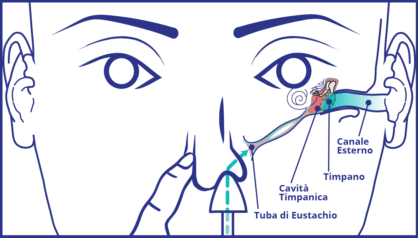 illustrazione Otosblok e tuba di Eustachio